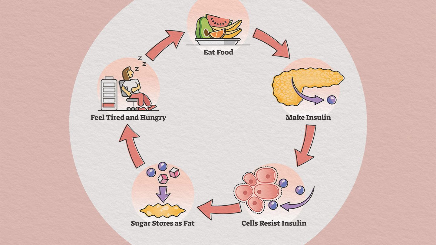 A diagram of insulin resistance in type 2 diabetes. It shows how insulin resistance can lead to type 2 diabetes. The diagram starts with a person eating food. The food is broken down into glucose, which is then transported into the cells by insulin. Insulin is a hormone that is produced by the pancreas. In people with type 2 diabetes, the cells are resistant to the effects of insulin. This means that the glucose cannot get into the cells and it builds up in the blood. This can lead to a number of problems, including fatigue, hunger, and weight gain. If left untreated, type 2 diabetes can lead to serious health problems, such as heart disease, stroke, and kidney failure.